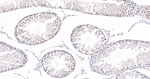 NUP98 Antibody in Immunohistochemistry (Paraffin) (IHC (P))