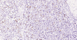 Phospho-CDK1/CDK2 (Thr14) Antibody in Immunohistochemistry (Paraffin) (IHC (P))