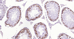 Phospho-CDK1/CDK2 (Thr14) Antibody in Immunohistochemistry (Paraffin) (IHC (P))