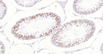 Phospho-CDK1/CDK2 (Thr14) Antibody in Immunohistochemistry (Paraffin) (IHC (P))