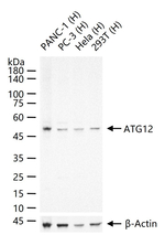 ATG12 Antibody in Western Blot (WB)