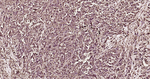 RhoA/RhoB/RhoC Antibody in Immunohistochemistry (Paraffin) (IHC (P))