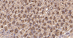 RhoA/RhoB/RhoC Antibody in Immunohistochemistry (Paraffin) (IHC (P))