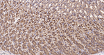 RhoA/RhoB/RhoC Antibody in Immunohistochemistry (Paraffin) (IHC (P))
