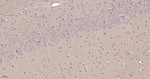 RhoA/RhoB/RhoC Antibody in Immunohistochemistry (Paraffin) (IHC (P))