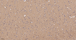 RhoA/RhoB/RhoC Antibody in Immunohistochemistry (Paraffin) (IHC (P))