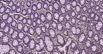 RhoA/RhoB/RhoC Antibody in Immunohistochemistry (Paraffin) (IHC (P))