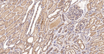 RhoA/RhoB/RhoC Antibody in Immunohistochemistry (Paraffin) (IHC (P))