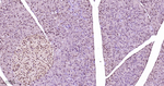HP1 alpha Antibody in Immunohistochemistry (Paraffin) (IHC (P))