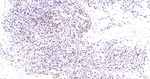 Androgen Receptor Recombinant Rabbit Monoclonal Antibody (3E14)