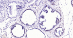Androgen Receptor Antibody in Immunohistochemistry (Paraffin) (IHC (P))