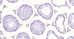 Androgen Receptor Antibody in Immunohistochemistry (Paraffin) (IHC (P))