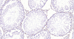 Androgen Receptor Antibody in Immunohistochemistry (Paraffin) (IHC (P))