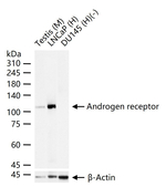 Androgen Receptor Antibody in Western Blot (WB)