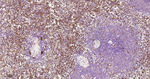 ATG7 Antibody in Immunohistochemistry (Paraffin) (IHC (P))