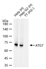 ATG7 Antibody in Western Blot (WB)