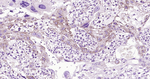 LAMP2 Antibody in Immunohistochemistry (Paraffin) (IHC (P))