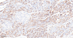 RPS3 Recombinant Rabbit Monoclonal Antibody (8C18)