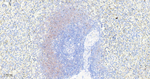RPS3 Antibody in Immunohistochemistry (Paraffin) (IHC (P))