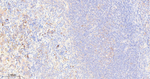 RPS3 Antibody in Immunohistochemistry (Paraffin) (IHC (P))