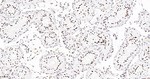 ASH2L Antibody in Immunohistochemistry (Paraffin) (IHC (P))