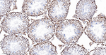 ASH2L Antibody in Immunohistochemistry (Paraffin) (IHC (P))