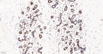 ASH2L Antibody in Immunohistochemistry (Paraffin) (IHC (P))