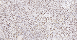 ASH2L Antibody in Immunohistochemistry (Paraffin) (IHC (P))