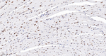 ASH2L Antibody in Immunohistochemistry (Paraffin) (IHC (P))