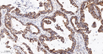 TOMM20 Antibody in Immunohistochemistry (Paraffin) (IHC (P))