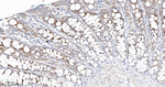 TOMM20 Antibody in Immunohistochemistry (Paraffin) (IHC (P))