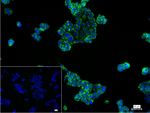 HK1 Recombinant Rabbit Monoclonal Antibody (20D12)