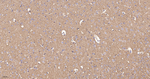 HK1 Antibody in Immunohistochemistry (Paraffin) (IHC (P))