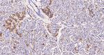 HK1 Antibody in Immunohistochemistry (Paraffin) (IHC (P))