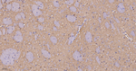 HK1 Antibody in Immunohistochemistry (Paraffin) (IHC (P))