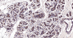 HK1 Antibody in Immunohistochemistry (Paraffin) (IHC (P))