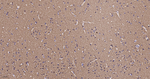 HK1 Antibody in Immunohistochemistry (Paraffin) (IHC (P))