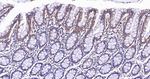 HK1 Antibody in Immunohistochemistry (Paraffin) (IHC (P))