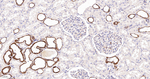 HK1 Antibody in Immunohistochemistry (Paraffin) (IHC (P))