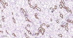 HK1 Antibody in Immunohistochemistry (Paraffin) (IHC (P))