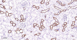 HK1 Antibody in Immunohistochemistry (Paraffin) (IHC (P))