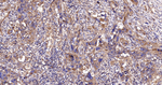 HK1 Antibody in Immunohistochemistry (Paraffin) (IHC (P))