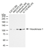HK1 Antibody in Western Blot (WB)