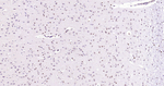DNMT3A Antibody in Immunohistochemistry (Paraffin) (IHC (P))