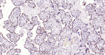 DNMT3A Antibody in Immunohistochemistry (Paraffin) (IHC (P))