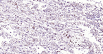 DNMT3A Antibody in Immunohistochemistry (Paraffin) (IHC (P))