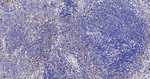 DNMT3A Antibody in Immunohistochemistry (Paraffin) (IHC (P))