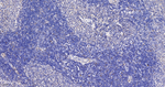 DNMT3A Antibody in Immunohistochemistry (Paraffin) (IHC (P))