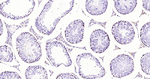 DNMT3A Antibody in Immunohistochemistry (Paraffin) (IHC (P))