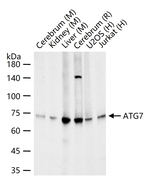 ATG7 Recombinant Rabbit Monoclonal Antibody (18E12)